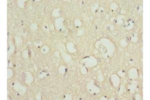 Immunohistochemistry of paraffin-embedded human brain tissue using ABIN7169937 at dilution of 1:100