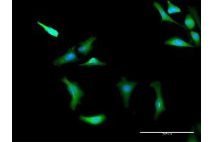 Immunofluorescence (IF) image for anti-Protein Kinase, AMP-Activated, gamma 2 Non-Catalytic Subunit (PRKAG2) (AA 1-328) antibody (ABIN526709)