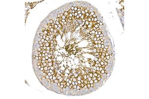 Immunohistochemistry of paraffin-embedded rat testis using GLUT3/SLC2 Rabbit pAb (ABIN6134111, ABIN6147961, ABIN6147962 and ABIN6224173) at dilution of 1:50 (40x lens). (SLC2A3 Antikörper  (AA 150-250))