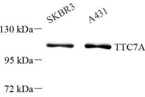 Western blot analysis of TTC7A (ABIN7075875) at dilution of 1: 1000 (TTC7A Antikörper)