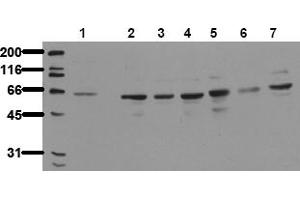 Western Blotting (WB) image for anti-P21-Activated Kinase 4 (PAK4) antibody (ABIN492621) (PAK4 Antikörper)