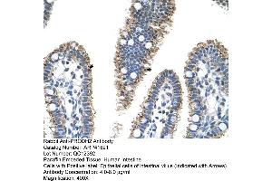 Rabbit Anti-PRODH2 Antibody  Paraffin Embedded Tissue: Human Intestine Cellular Data: Epithelial cells of intestinal villas Antibody Concentration: 4. (PRODH2 Antikörper  (C-Term))