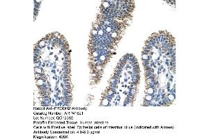 Rabbit Anti-PRODH2 Antibody  Paraffin Embedded Tissue: Human Intestine Cellular Data: Epithelial cells of intestinal villas Antibody Concentration: 4.