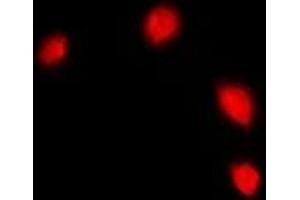 Immunofluorescent analysis of IFI16 staining in U2OS cells. (IFI16 Antikörper)