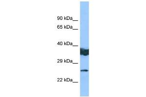 WB Suggested Anti-LYPLAL1 Antibody Titration: 1. (LYPLAL1 Antikörper  (Middle Region))