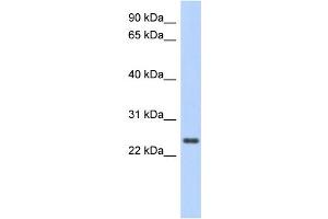WB Suggested Anti-CCDC70 Antibody Titration: 0. (CCDC70 Antikörper  (Middle Region))
