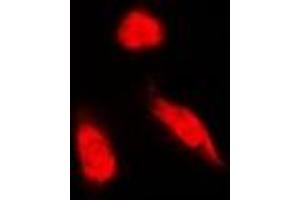 Immunofluorescent analysis of NCK1 staining in Hela cells. (NCK1 Antikörper)