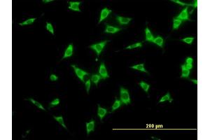 Immunofluorescence of monoclonal antibody to NCOA4 on NIH/3T3 cell. (NCOA4 Antikörper  (AA 505-614))