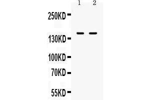 Western Blotting (WB) image for anti-Integrin alpha-L (ITGAL) (AA 161-349) antibody (ABIN5518766)