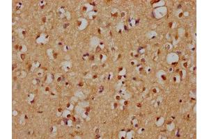IHC image of ABIN7157954 diluted at 1:200 and staining in paraffin-embedded human brain tissue performed on a Leica BondTM system. (RANBP3L Antikörper  (AA 170-295))