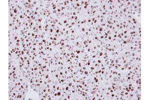 Immunohistochemistry (IHC) image for anti-LIM Domain Binding 1 (LDB1) antibody (ABIN2855846)