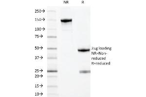 SDS-PAGE Analysis Purified MYADM Mouse Monoclonal Antibody (MYADM/971).