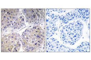 Immunohistochemistry (IHC) image for anti-Solute Carrier Family 27 (Fatty Acid Transporter), Member 5 (SLC27A5) (Internal Region) antibody (ABIN1850922) (SLC27A5 Antikörper  (Internal Region))