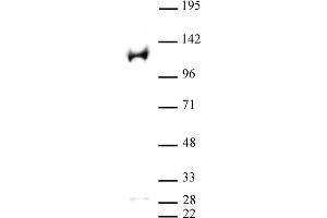 PARP-1 N-terminal antibody (pAb) tested by Western blot. (PARP1 Antikörper  (N-Term))