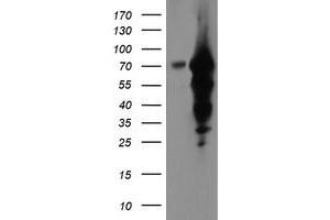Western Blotting (WB) image for anti-Epsin 2 (EPN2) antibody (ABIN1498052) (Epsin 2 Antikörper)