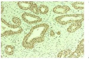 Immunohistochemistry (IHC) image for anti-THO Complex 1 (THOC1) (C-Term) antibody (ABIN2778931)