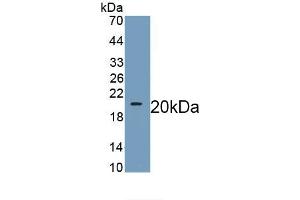 Detection of Recombinant WNT11, Human using Monoclonal Antibody to Wingless Type MMTV Integration Site Family, Member 11 (WNT11) (WNT11 Antikörper  (AA 204-349))