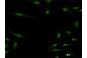 Immunofluorescence of monoclonal antibody to RBM15 on HeLa cell.