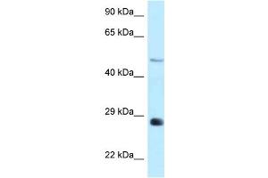 WB Suggested Anti-Agpat9 Antibody Titration: 1. (AGPAT9 Antikörper  (Middle Region))