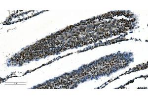 IHC analysis of CDC45L using anti-CDC45L antibody (ABIN7600230). (CDC45 Antikörper  (AA 166-431))