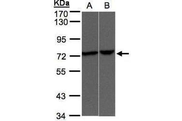 TRPV2 antibody  (C-Term)