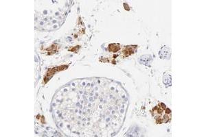 Immunohistochemical staining of human testis with EBP polyclonal antibody  shows strong cytoplasmic positivity in Leydig cells. (EBP Antikörper)