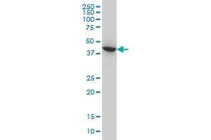 ACAA2 monoclonal antibody (M01), clone 5C4 Western Blot analysis of ACAA2 expression in HeLa . (ACAA2 Antikörper  (AA 151-260))