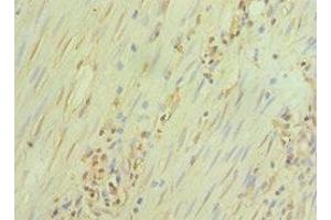 Immunohistochemistry of paraffin-embedded human epityphlon tissue using ABIN7172390 at dilution of 1:100 (GATA3 Antikörper  (AA 1-260))
