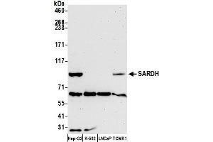 anti-Sarcosine Dehydrogenase (SARDH) (AA 868-918) antibody