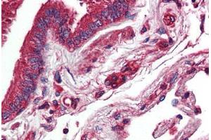 Immunohistochemistry (IHC) image for anti-Nuclear Receptor Subfamily 1, Group D, Member 2 (NR1D2) (N-Term) antibody (ABIN1049134)