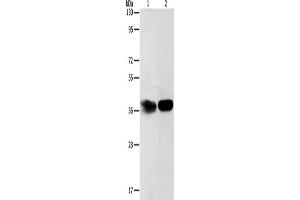 Gel: 12 % SDS-PAGE, Lysate: 40 μg, Lane 1-2: Hela cells, mouse kidney tissue, Primary antibody: ABIN7189696(ADPRHL2 Antibody) at dilution 1/500, Secondary antibody: Goat anti rabbit IgG at 1/8000 dilution, Exposure time: 2 minutes