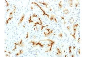Formalin-fixed, paraffin-embedded human Pancreas stained with CFTR Rabbit Recombinant Monoclonal Antibody (CFTR/1775R). (Rekombinanter CFTR Antikörper  (AA 258-385))