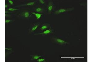 Immunofluorescence of purified MaxPab antibody to HCK on HeLa cell.