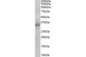 Western Blotting (WB) image for anti-Coiled-Coil Domain Containing 114 (CCDC114) (C-Term) antibody (ABIN2774525) (CCDC114 Antikörper  (C-Term))