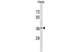 ZSCAN23 Antibody (Center) (ABIN1882043 and ABIN2838990) western blot analysis in Hela cell line lysates (35 μg/lane). (ZSCAN23 Antikörper  (AA 200-229))