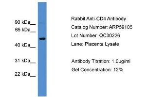 WB Suggested Anti-CD4  Antibody Titration: 0. (CD4 Antikörper  (C-Term))