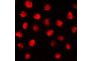 Immunofluorescent analysis of EGR1 staining in MCF7 cells. (EGR1 + EGR2 (C-Term) Antikörper)