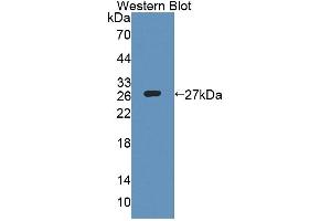 Detection of Recombinant COVA1, Human using Polyclonal Antibody to Cytosolic Ovarian Carcinoma Antigen 1 (COVA1) (ENOX2 Antikörper  (AA 1-207))