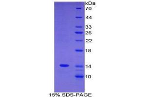 SDS-PAGE analysis of Mouse C4BPa Protein. (C4BPA Protein)