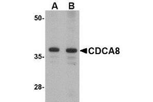 Western blot analysis of CDCA8 in Rat kidney lysate with AP30218PU-N CDCA8 antibody at (A) 1 and (B) 2 μg/ml. (CDCA8 Antikörper  (N-Term))
