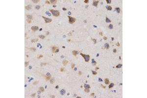Immunohistochemistry of paraffin-embedded rat brain using KPNA4 Antibody (ABIN5971058) at dilution of 1/200 (40x lens). (KPNA4 Antikörper)