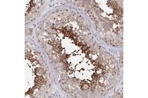 Immunohistochemical staining of human testis with SLC26A8 polyclonal antibody  shows strong cytoplasmic and moderate nuclear positivity in cells in seminiferous ducts at 1:1000-1:2500 dilution.
