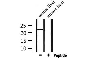 Western blot analysis of extracts from mouse liver, using FGF9 Antibody. (FGF9 Antikörper  (N-Term))