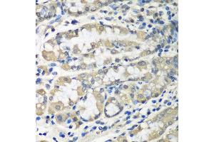 Immunohistochemistry of paraffin-embedded human stomach using CCT6A antibody at dilution of 1:100 (40x lens). (CCT6A Antikörper)