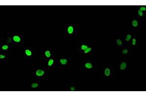 Immunofluorescent analysis of HepG2 cells (sodium butyrate, 30 mM, 4h) using ABIN7139164 at dilution of 1:100 and Alexa Fluor 488-congugated AffiniPure Goat Anti-Rabbit IgG(H+L) (Histone H1.5 Antikörper  (acLys16))
