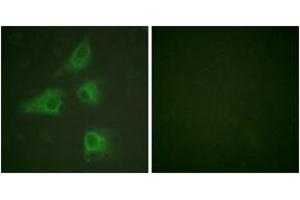 Immunofluorescence analysis of HeLa cells, using DRP-2 (Ab-514) Antibody.