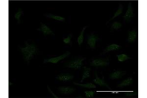 Immunofluorescence of monoclonal antibody to SP3 on HeLa cell.