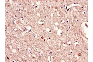 Immunohistochemistry of paraffin-embedded human brain tissue using ABIN7167318 at dilution of 1:100 (RAB39B Antikörper  (AA 1-213))