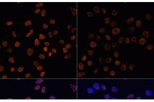 Immunofluorescence analysis of HeLa cells using Acetyl-Histone H2A-K5 Polyclonal Antibody at dilution of 1:100. (Histone H2A Antikörper  (acLys5))