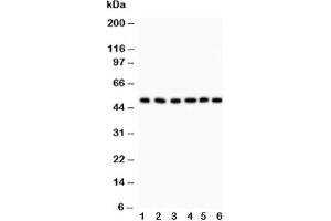Western blot testing of GFAP antibody and Lane 1:  rat brain;  2: mouse brain;  3: U87;  4: SHG-44 (human glioma line);  5: NEURO;  6: HeLa lysate (GFAP Antikörper  (AA 93-432))